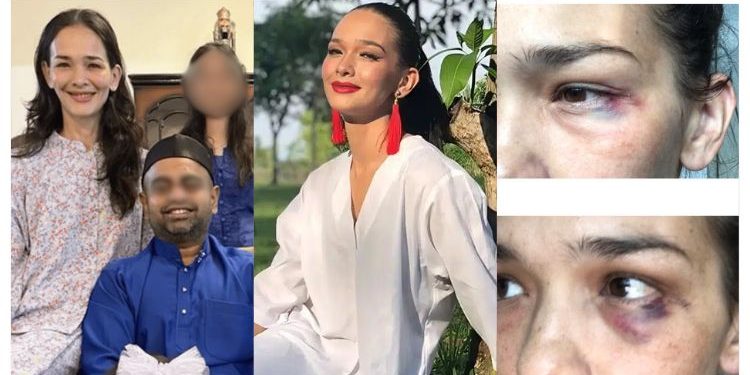 Pendedahan Kisah Duka Rumah Tangga Zahnita Wilson Jadi Perhatian