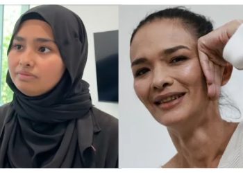 Gambar Mata Lebam Zahnita Wilson Hanya Foto Lama?