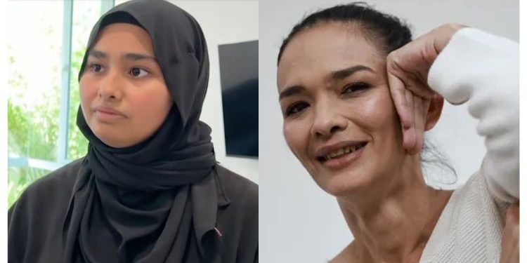 Gambar Mata Lebam Zahnita Wilson Hanya Foto Lama?