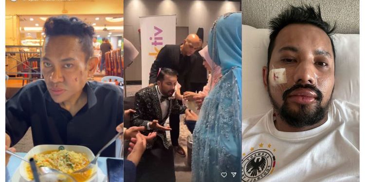 Razman & Razmi Diserang Gara-Gara Isu Hutang – “Kalau M4ti Macam Mana?”